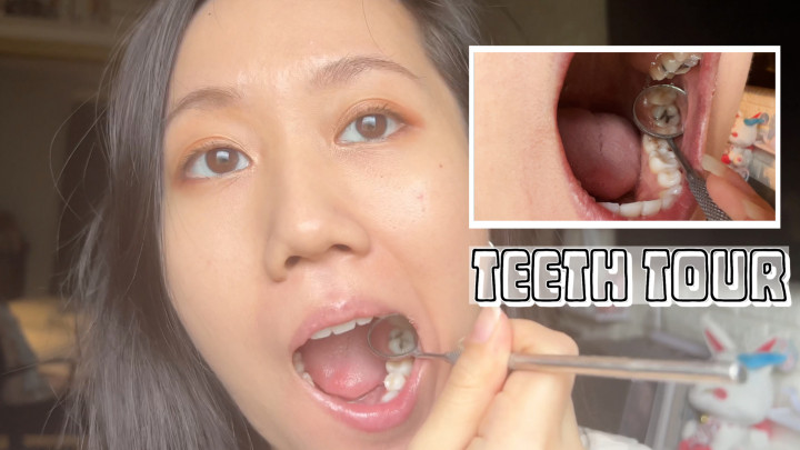 leaked Cavities Teeth Tour thumbnail