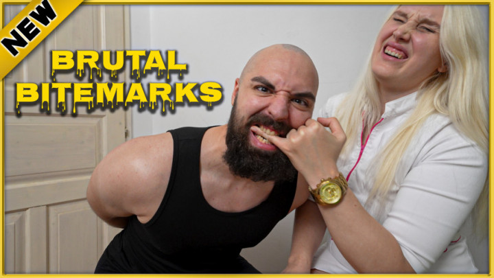 Diane Chrystall:Aggressive Finger Biting: Brutl Bitemarks