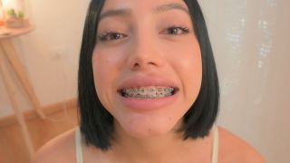 Nice mouth full of braces magic_secret
