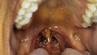 [875.06 MB] - Uvula fetish - GoldenLace