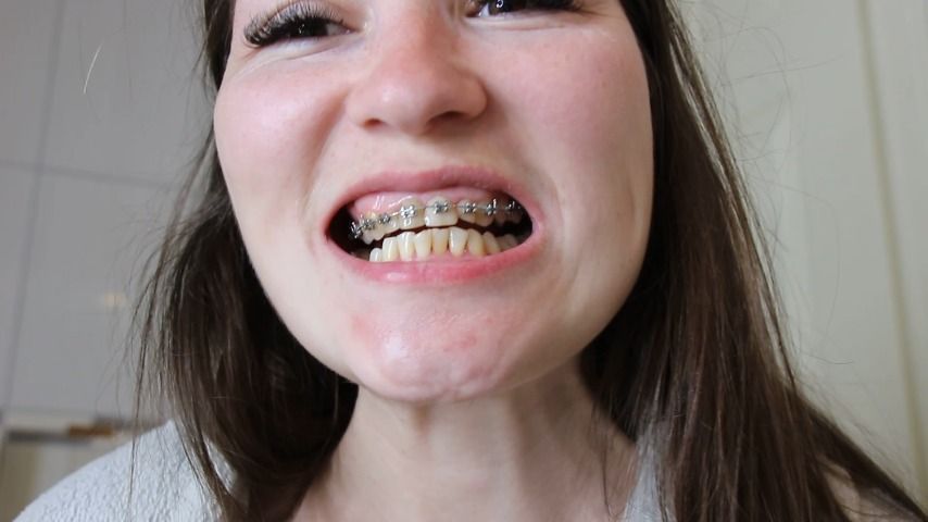 leaked Cleaning my braces thumbnail