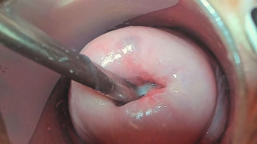 Andradahot - Extreme Cervix Fucking - ManyVids