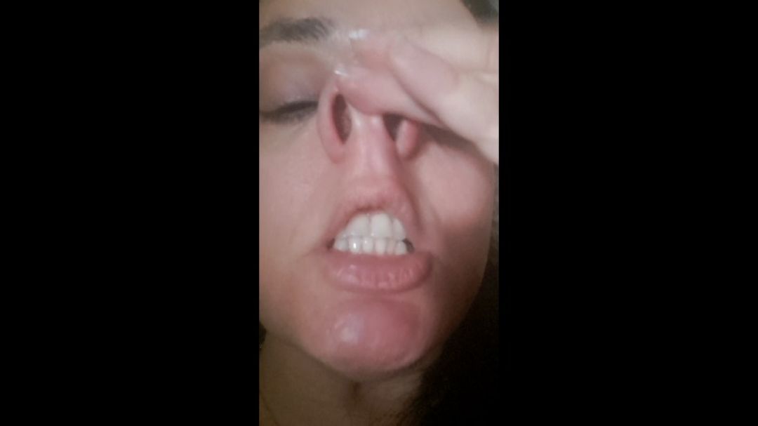 Vicky Vera:Piggy nose and hairy nostrils
