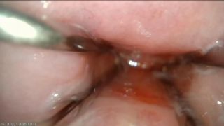 endocervical speculum extreme closeup strangecares