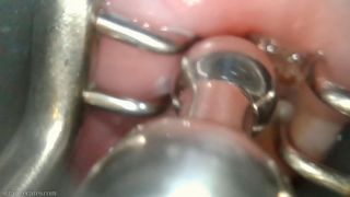 cervix pried open and penetrated strangecares