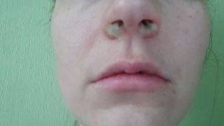 [307.81 MB] - Blowing my nose - GellaG