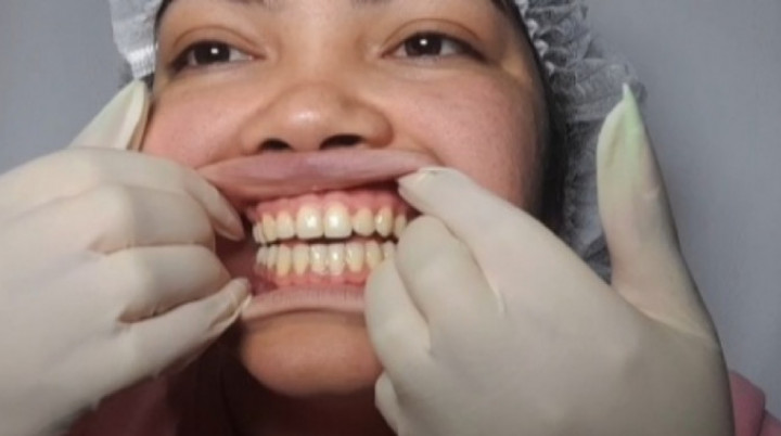 Fetish Jessie:Oral inspection for yellow teeth