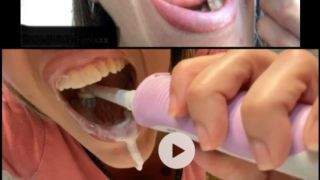 [170.88 MB] - DIRTY MOUTH AFTER EATING and Brushing Te - Repre Fenix10