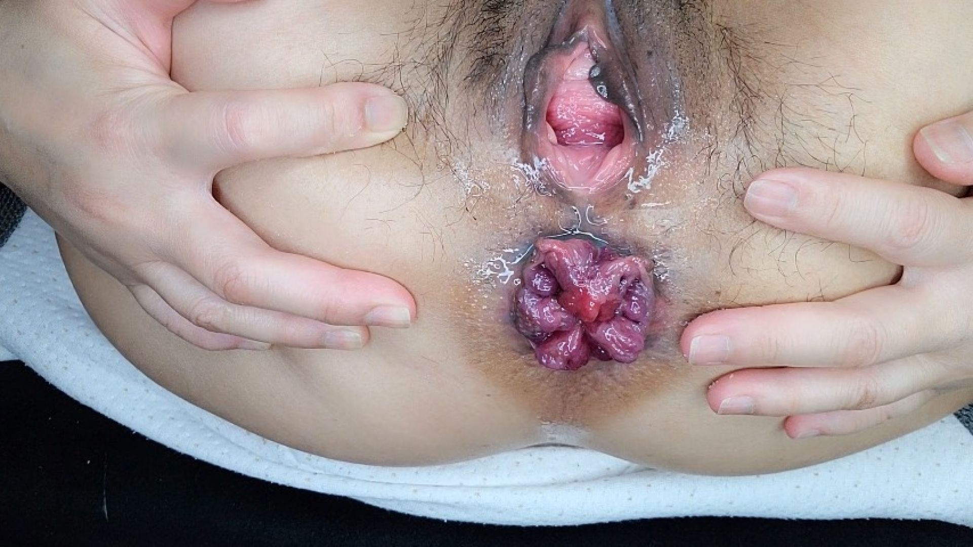 Mycookies10k:Extremely Loud Farts With Prolapse