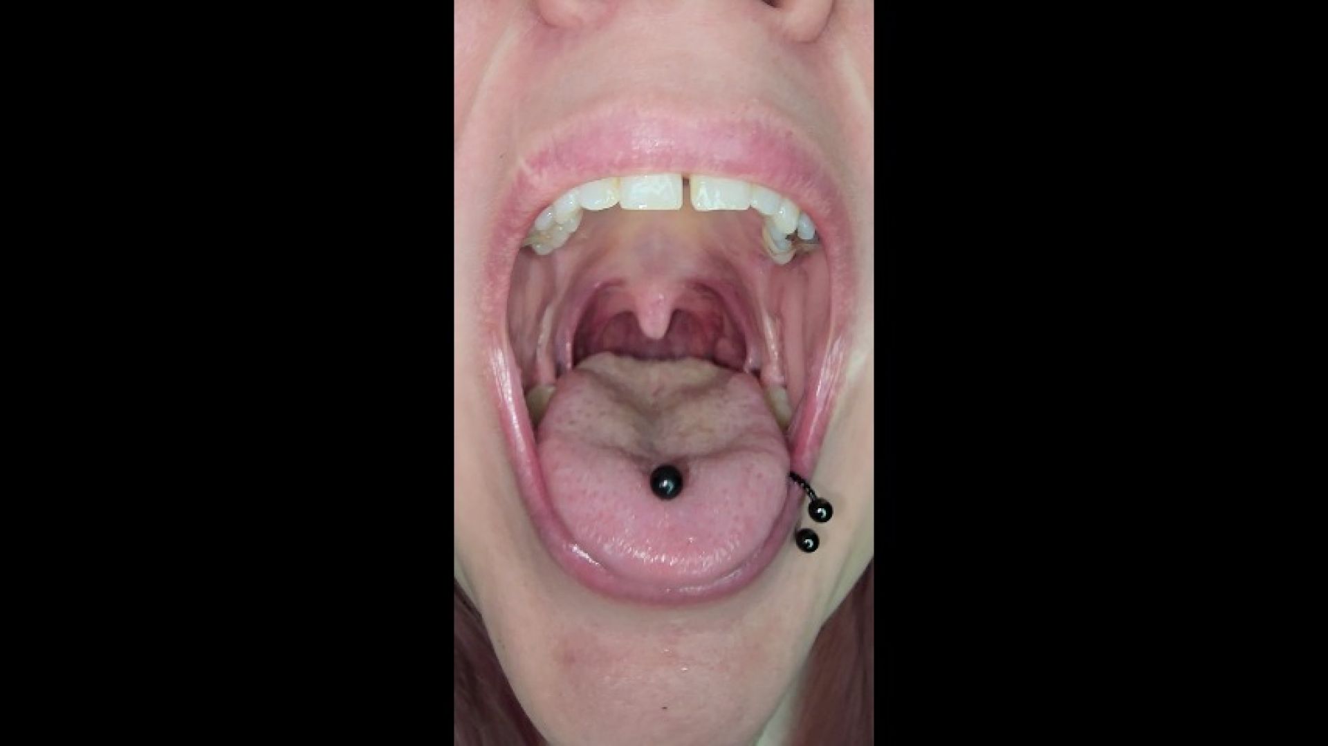 Uvula challenge