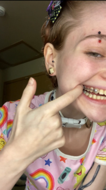 Tinygingerxx:Drooly Oral fixation w Rubber Bands and Retainer