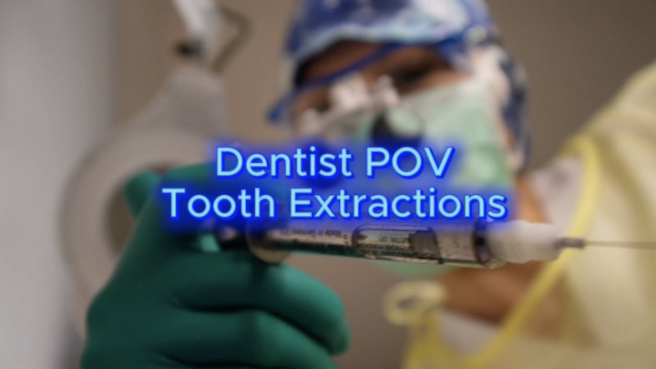 Luna9292rose:POV Professional Dental Exam &amp;amp; Extractions