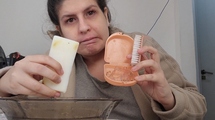 abigaillatina:Deep Cleaning My Retainers