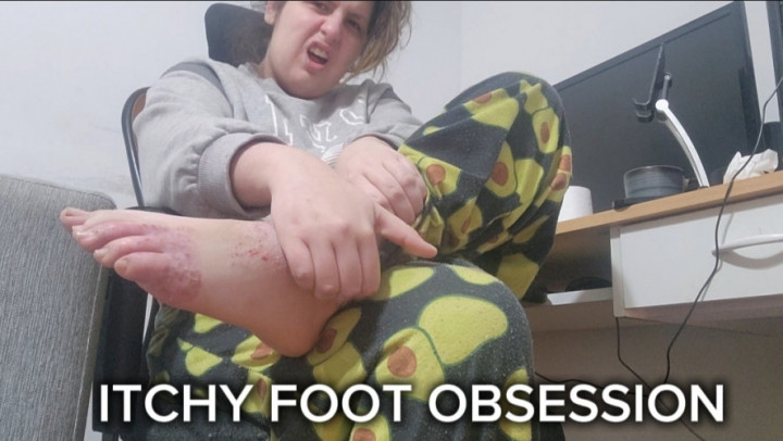 abigaillatina:My Foot Itch Obsession  Scratching Like Crazy