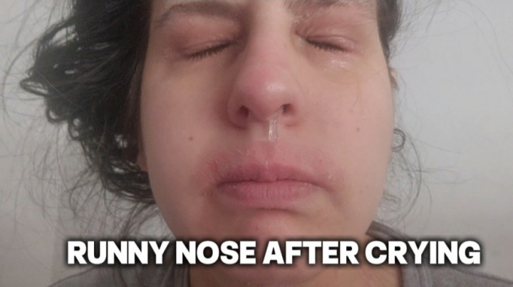 abigaillatina:Runny nose and nose blowing after crying