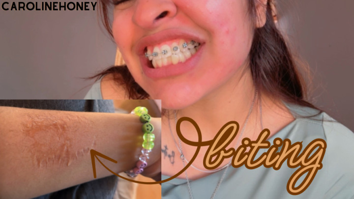 Carolinehoney:biting my hairy arms