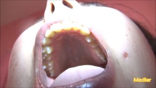 [606.47 MB] - Sexy palate [HOPE - The Pink House